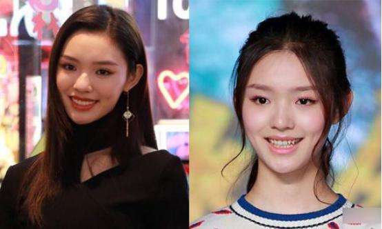 王俊凯牙齿是露出来的吗,王俊凯真的整牙了吗