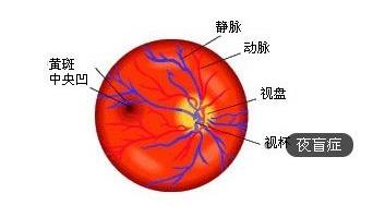 眼睛得了夜盲症,夜盲症的诊断方法