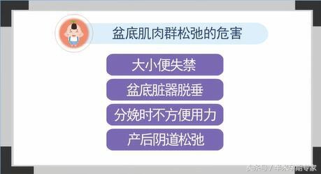 什么是凯格尔运动怎样做,什么是凯格尔运动教学视频