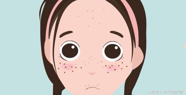 孕期腋下胸部黑色素沉淀怎么去除,孕期胸部黑色素沉淀产后多久恢复