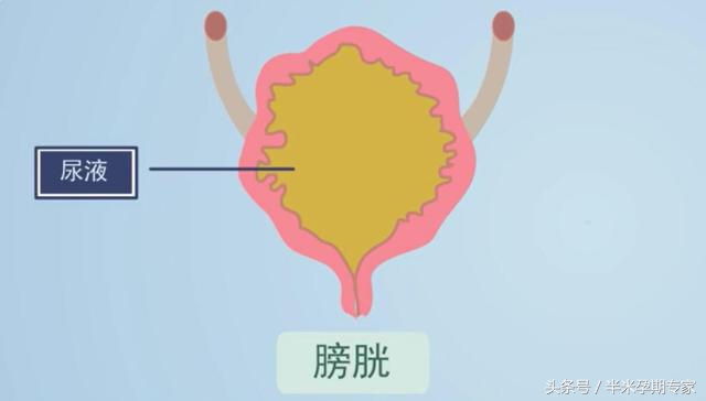 产后尿潴留2000ml,产后尿潴留针灸