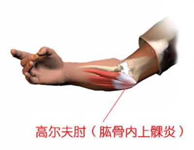 打高尔夫关注哪些事项,高尔夫对身体的伤害