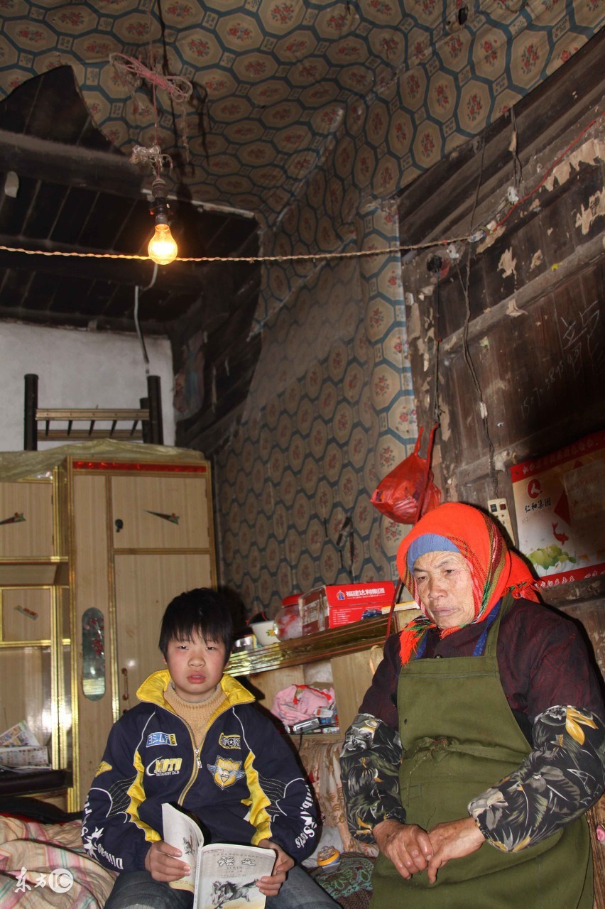 皮肌炎的危害有哪些,皮肌炎怎么预防肌肉萎缩