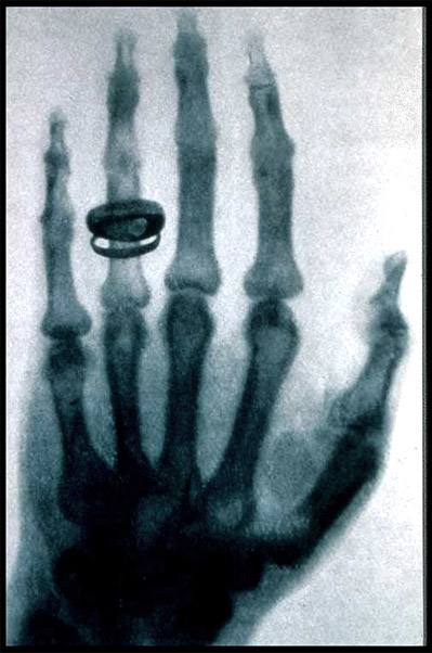 x光ct和核磁共振b超的区别,x光ct磁共振b超有什么区别