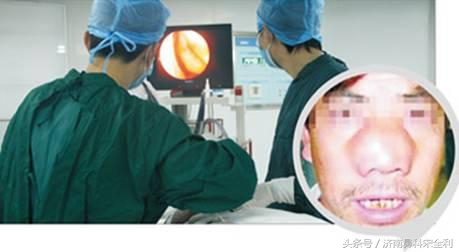 鼻息肉术后为什么会复发,鼻息肉手术后又复发了怎么处理