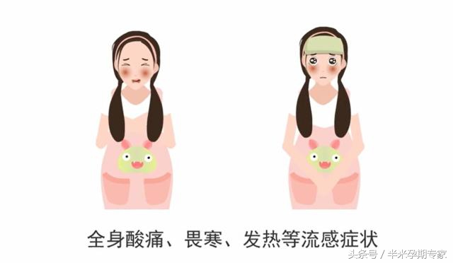 妊娠合并病毒性肝炎综合征,妊娠合并病毒性肝炎