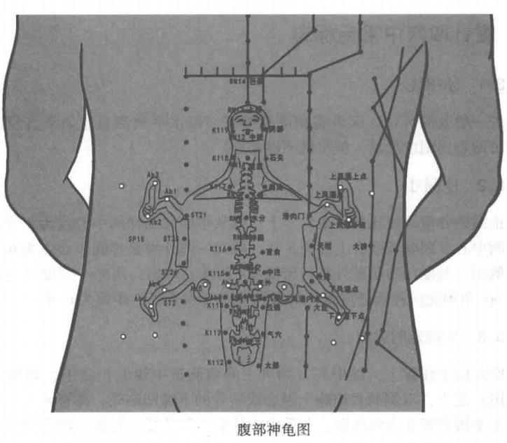 中医针灸腹针,中医大神针