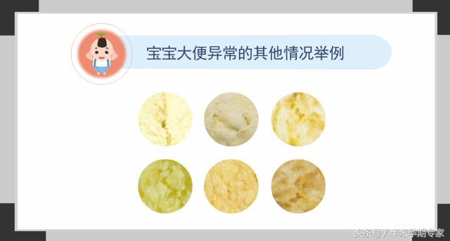 宝宝大便发黑有恶臭,宝宝便便粘稠有黑色物特臭