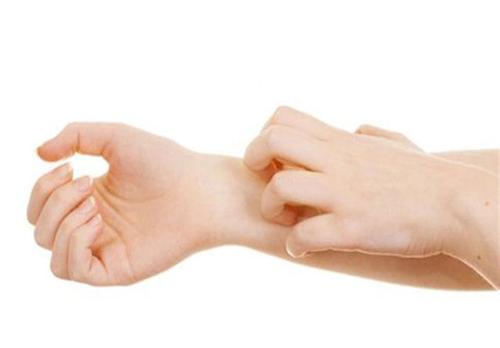 急性湿疹怎么快速治疗,硬皮湿疹的快速治疗方法