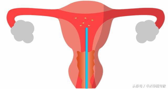男性不育吃什么中药,男性不育应该怎么办
