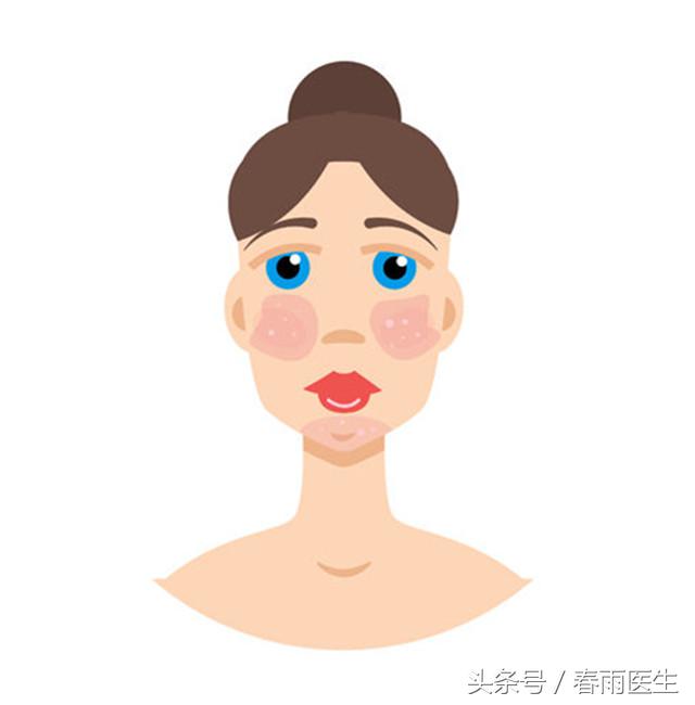 经常整个脸红是什么病的前兆,小脸红彤彤是怎么回事