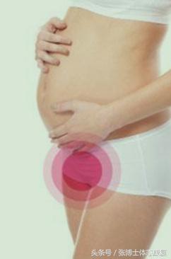 孕期耻骨疼康复理疗,孕期运动疗法图片