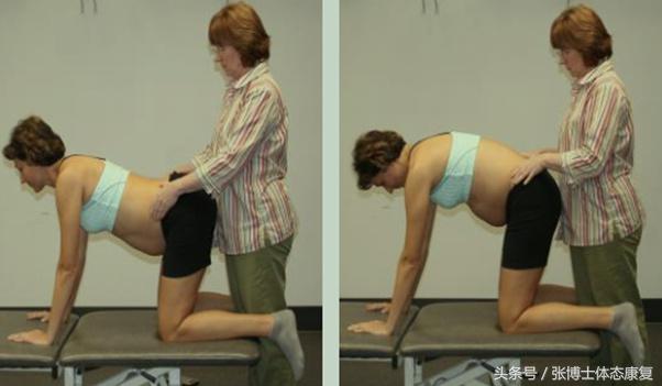 孕期耻骨疼康复理疗,孕期运动疗法图片