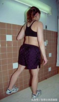 孕期耻骨疼康复理疗,孕期运动疗法图片