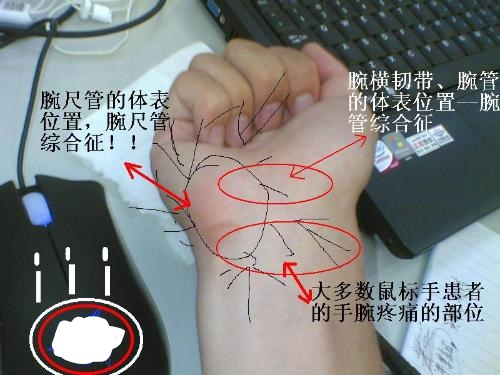 坐一会就头晕想吐,坐一会起来就头晕