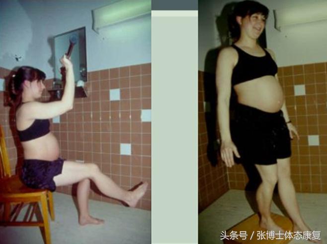 孕期耻骨疼康复理疗,孕期运动疗法图片