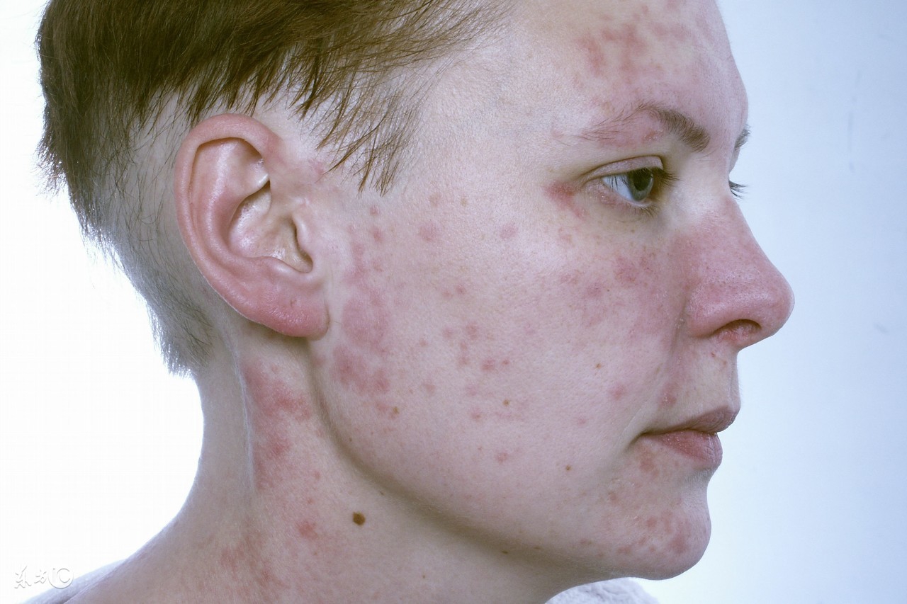 吃雪莲的坏处,吃雪莲果的危害有多大