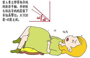 如何区分漏尿和羊水早破？发生羊水早破这3点错误做法，不可不知