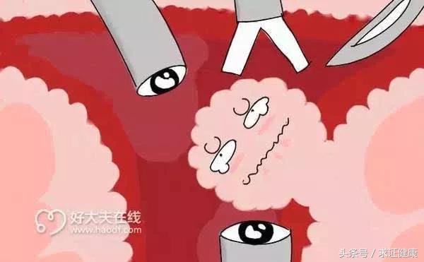 怀孕为啥长子宫肌瘤,年纪轻轻为什么有子宫肌瘤