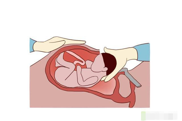 女人一生最多能做几回剖腹产,女人一生最多可以承受生几个孩子