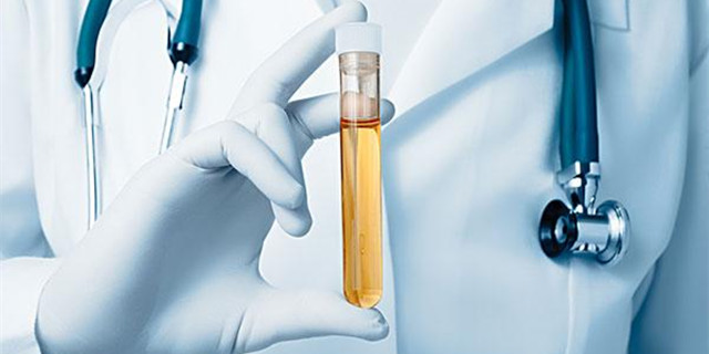 孕妇尿检查什么项目,尿检能检查出什么病