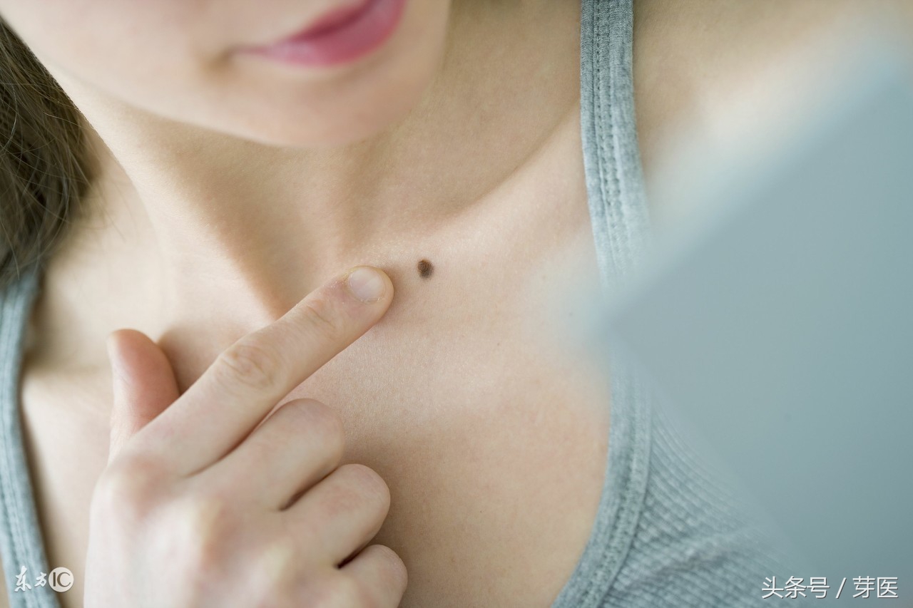 人体为什么会出现黑痣和红痣,从小就有凸起的痣是黑色素瘤吗