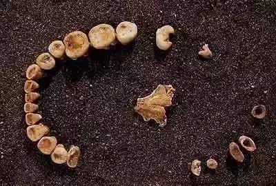 他们口含尿液治牙病，还为一口好牙不惜盗尸掘墓、奔赴战场