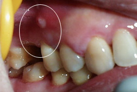 牙痛不是病疼起来真的要命,很多人说牙痛不是病痛起来真要命