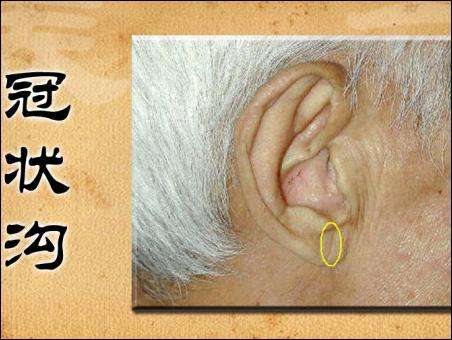 有这几个症状当心心梗正悄悄发生,心血管堵塞导致的心梗有什么前兆