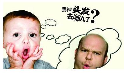 脱发什么时候才能有救,绝顶聪明头发少