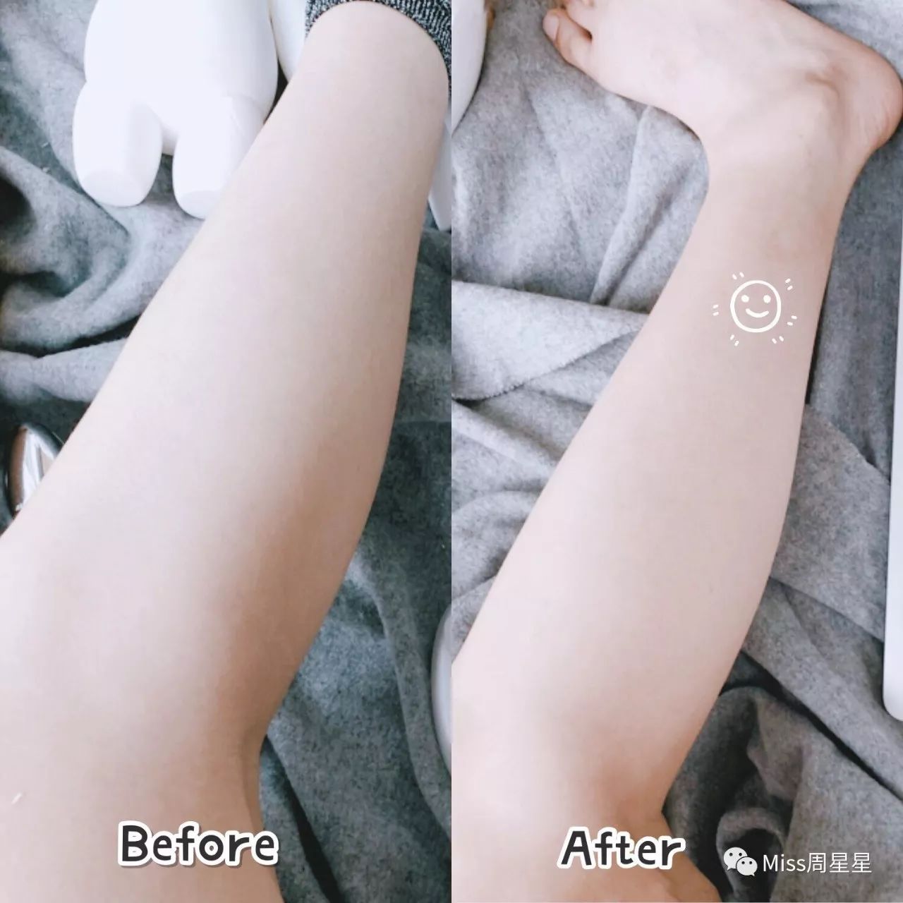 wellbox美容仪,wellbox美容仪用法