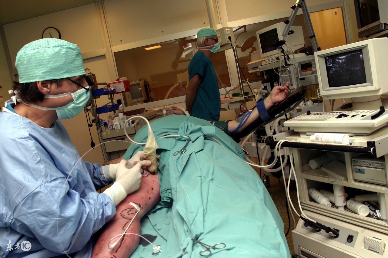 腿部静脉曲张血液是怎么回流的,下肢静脉曲张并发症及处理方法