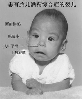 怀孕一个月喝酒对胎儿有害吗,怀孕吸入酒精对胎儿是否有害