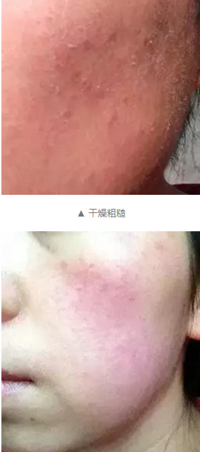 孕妇皮肤变差如何护肤,怀孕期多护肤皮肤是不是会变好