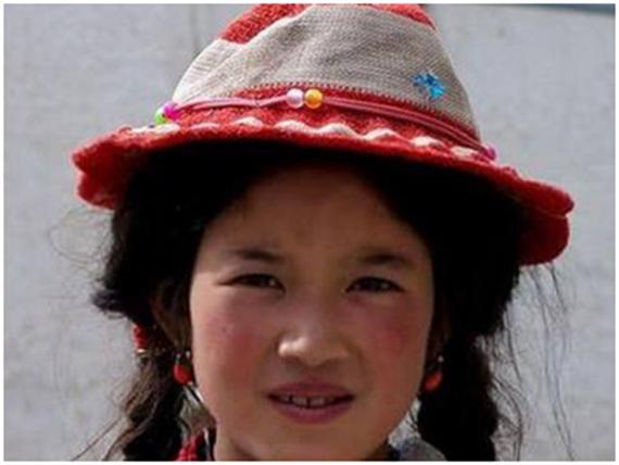 高原红应该怎么治疗,高原红如何处理