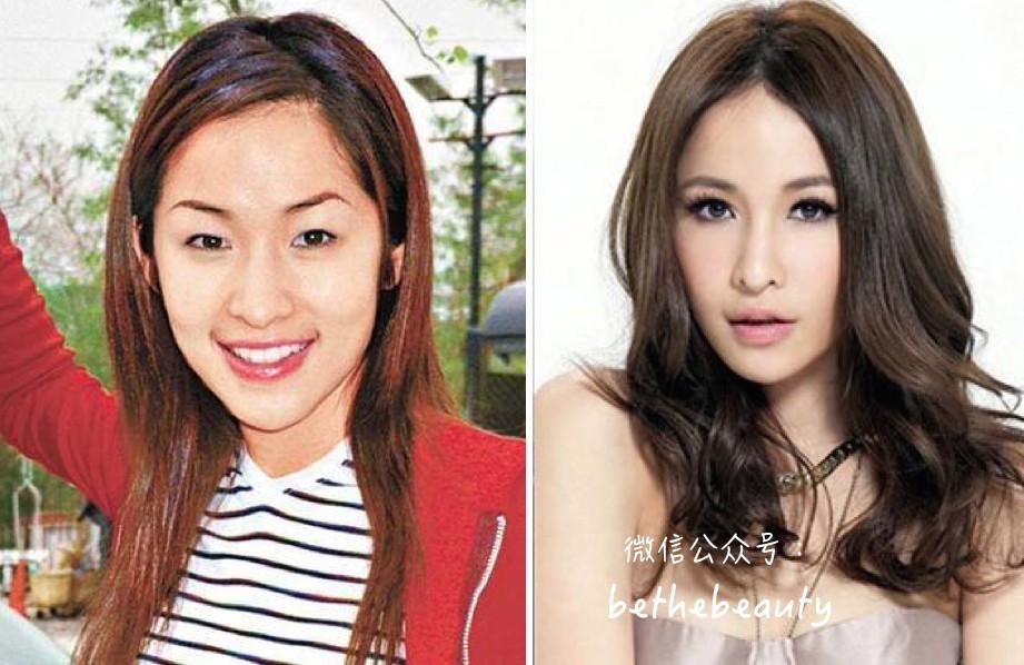 注定又显man又显老？拯救瘦长脸，就靠这篇了！