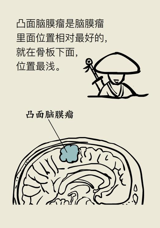 脑袋里长瘤子一定要切除吗,脑袋里长瘤能治好吗