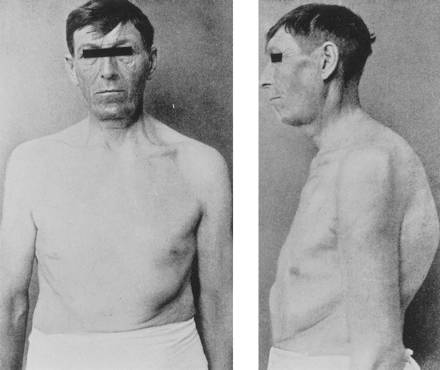 不敢说“空前”，但一定是“绝后”：宫刑到底是怎么一回事？