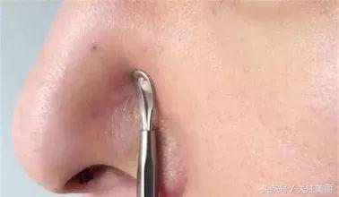 隆鼻后鼻子红肿怎么回事,隆鼻后鼻子肿胀是怎么回事