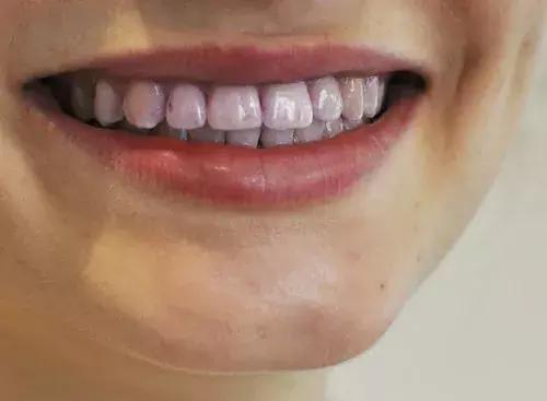 喝完酒牙齿发涩,喝酒后嘴唇紫是什么原因