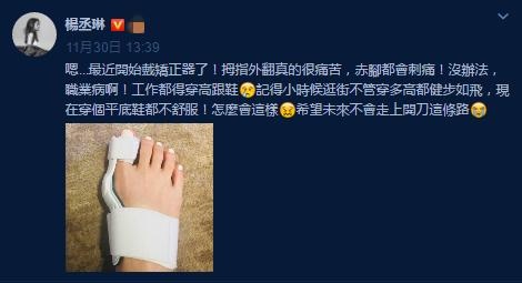 杨丞琳用黑绷带,杨丞琳安慰粉丝视频