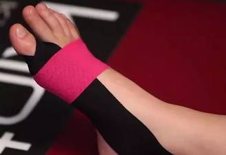 大脚趾外翻的自我改善,大脚趾外翻怎么矫正锻炼