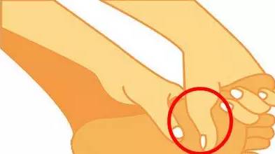 大脚趾外翻的自我改善,大脚趾外翻怎么矫正锻炼