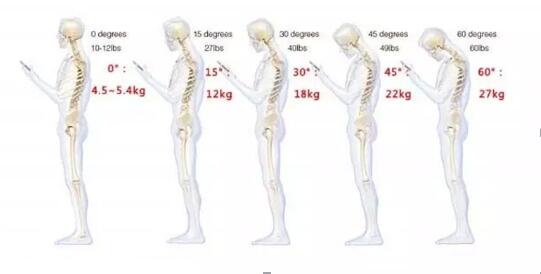 手麻手僵硬是哪种颈椎病导致的,手麻是颈椎病造成应看什么科