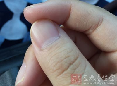 如何从指甲检查出身体状况,怎样通过指甲了解健康状况