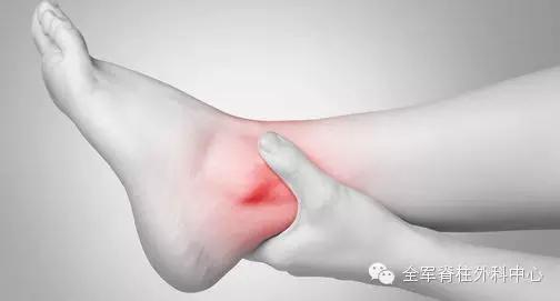 崴脚了怎么办图片,崴脚脖子伤筋了怎么办