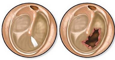 一不留神竟让孩子鼓膜穿孔！孩子身上这个地方可不是你想碰就能碰