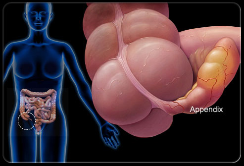 盆腔疼痛怎么引起的,盆腔疼痛是什么原因引起的