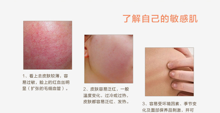 肝不好皮肤容易过敏吗,容易造成皮肤过敏的药