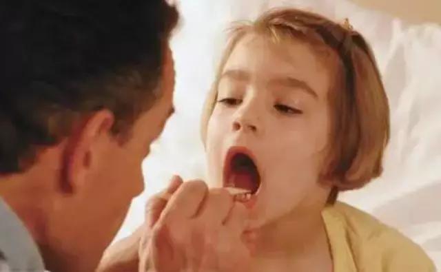 春天上火嗓子疼吃什么药,春天上火嗓子哑